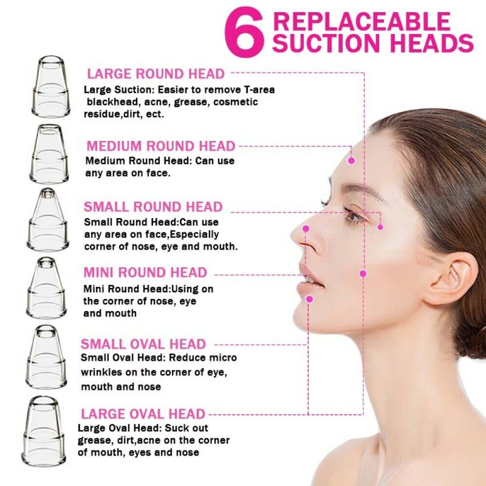 Electric Blackhead Remover