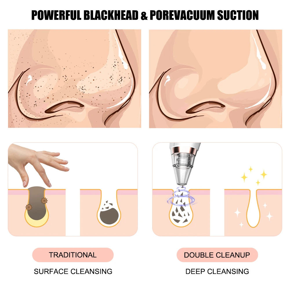 Electric blackhead removal and pore cleaning